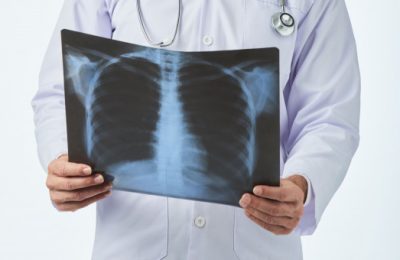 Новосибирцев приглашают пройти скрининг легких рядом с метро